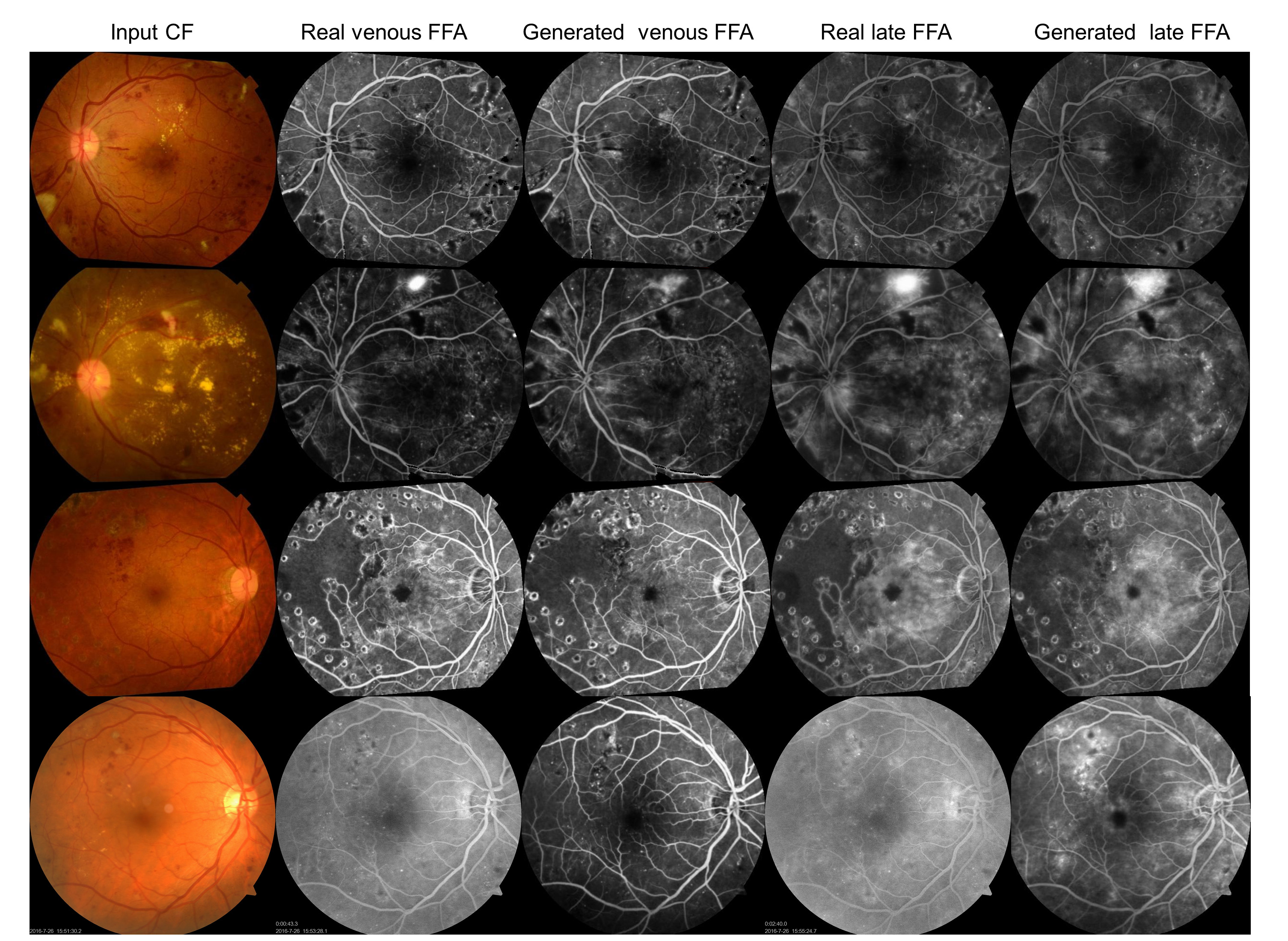 Development and Clinical Validation of AI-Based Software as a Medical Device for Non-Invasive Ophthalmic Imaging and Automated Reporting